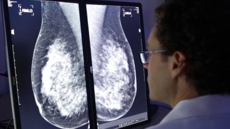 CureMetrix gets FDA clearance for mammogram-screening system